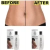stretch mark cream dr james