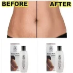 stretch mark cream dr james